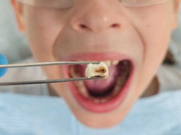 Best Emergency Tooth Extraction  in Sanford, FL